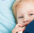 Фото: http://dermatologiya.com/wp-content/uploads/2018/01/11.jpg - KaliningradToday.Ru